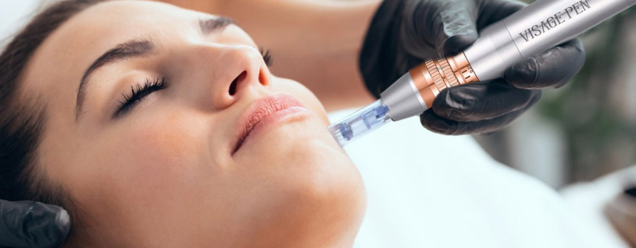 Microneedling
