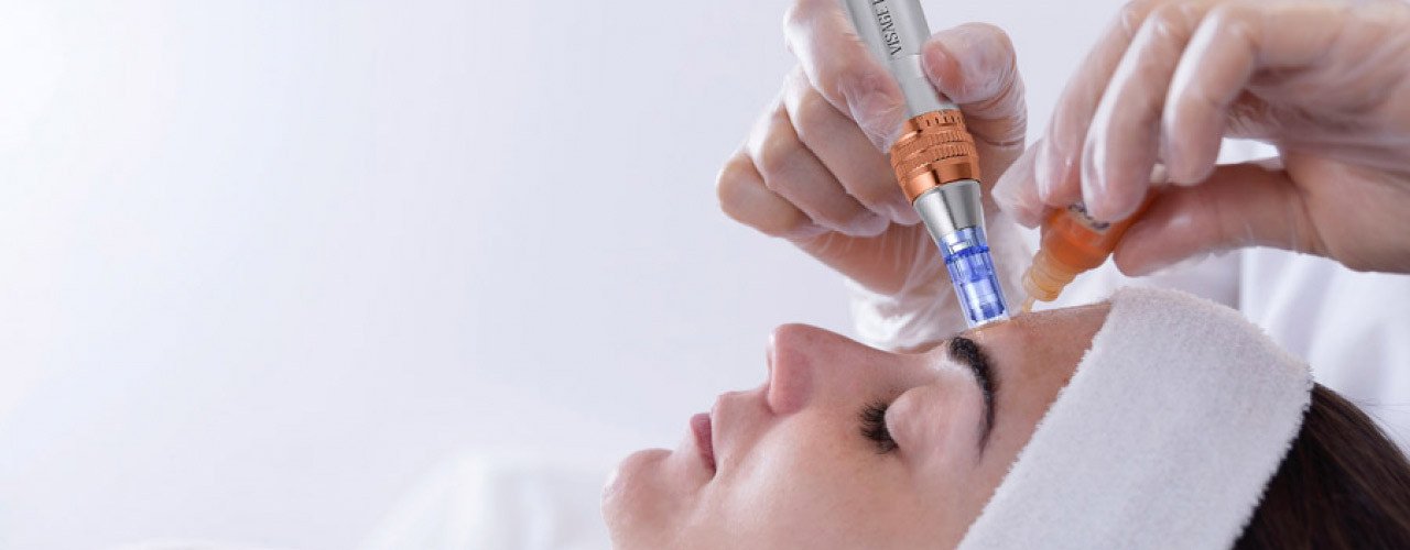 Was ist Microneedling