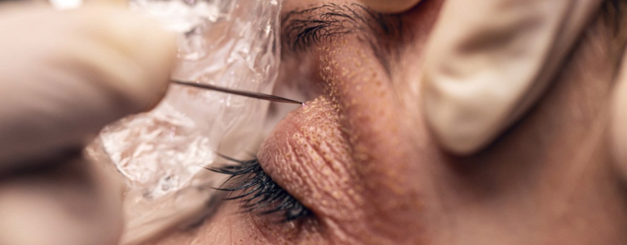 Visage Plasma Skin Behandlung